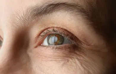 Free Cataract surgeries in Pakistan